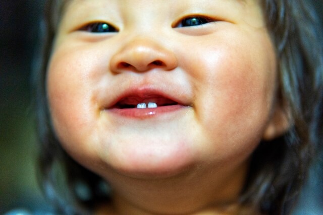 前歯が日本ある赤ちゃん